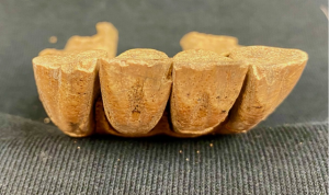 Damaged lower incisors from Elverton, Westminster. Enamel is worn smooth on the front of the teeth